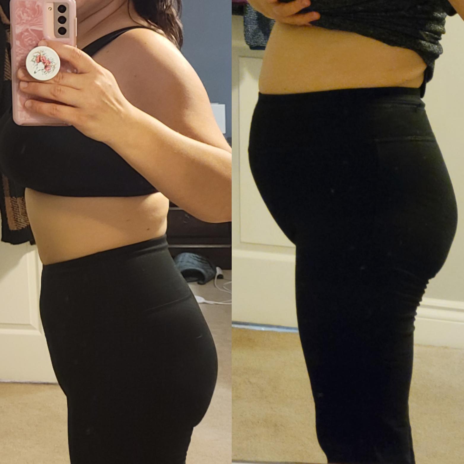 Antes — barriga inchada e desconforto