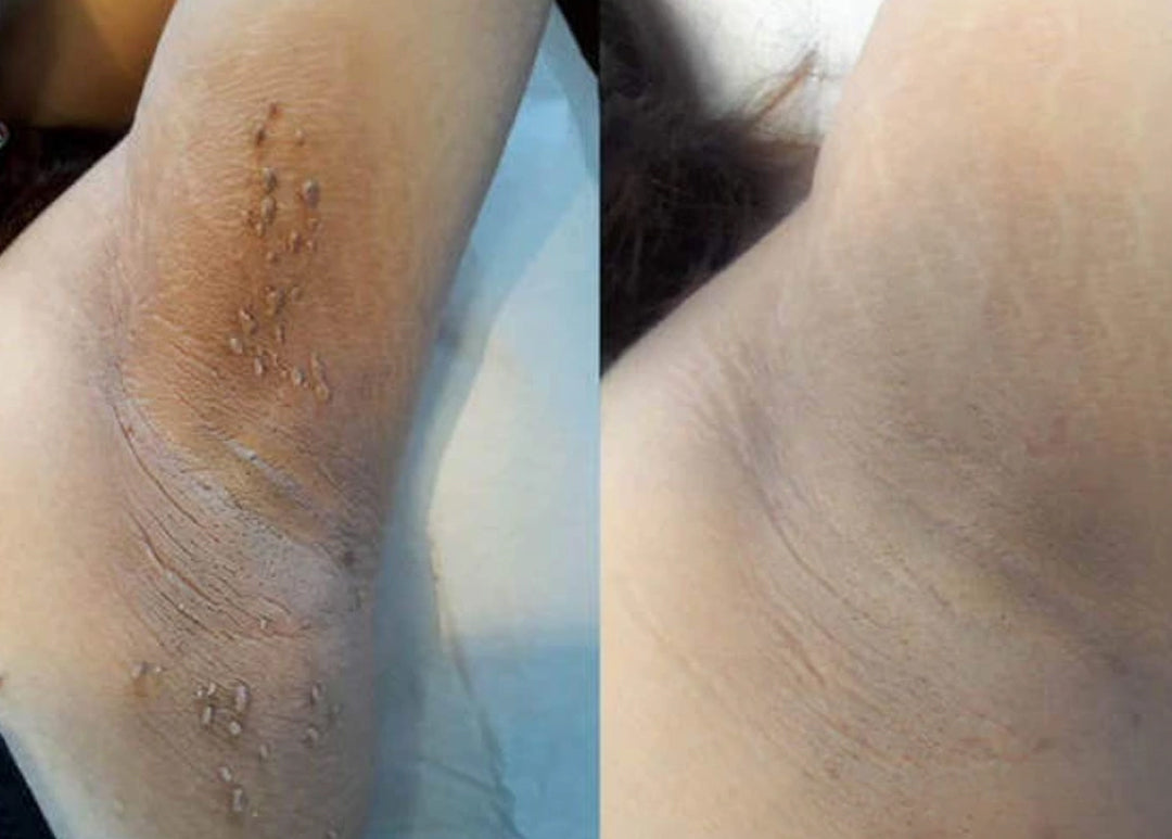 Antes e Depois 2