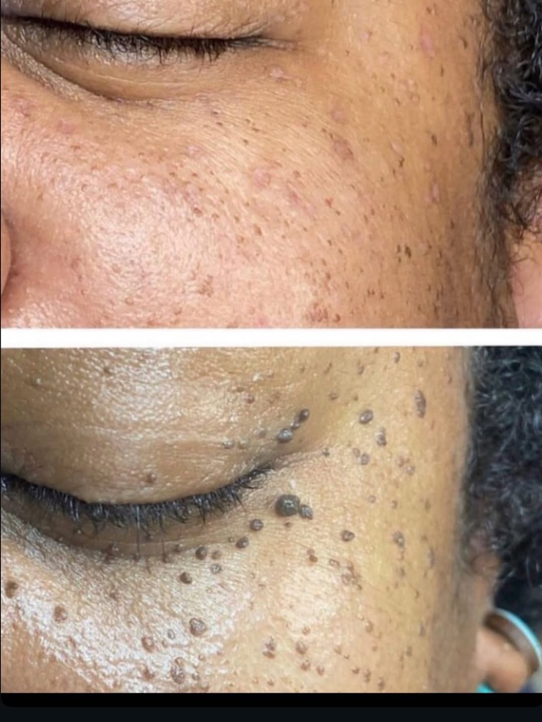 Resultado antes e depois — Tatiane A.