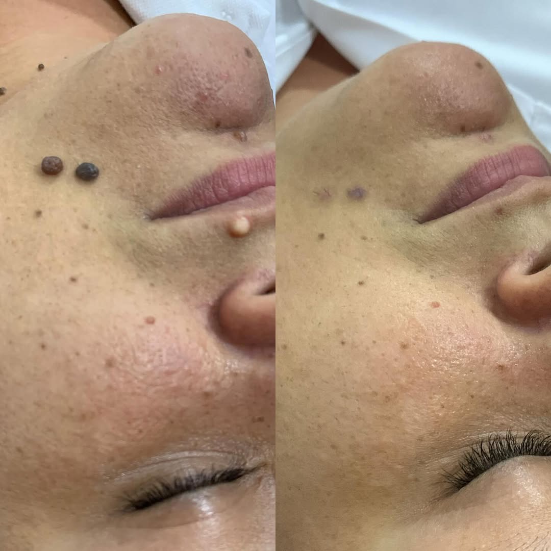 Resultado antes e depois — Rogéria B.