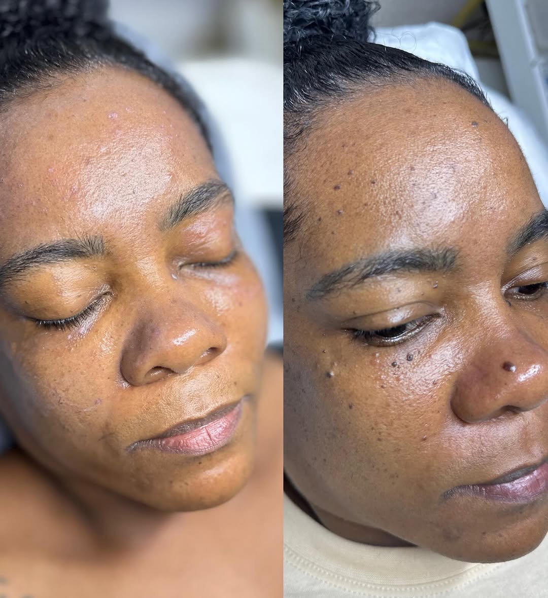 Resultado antes e depois — Carla M.