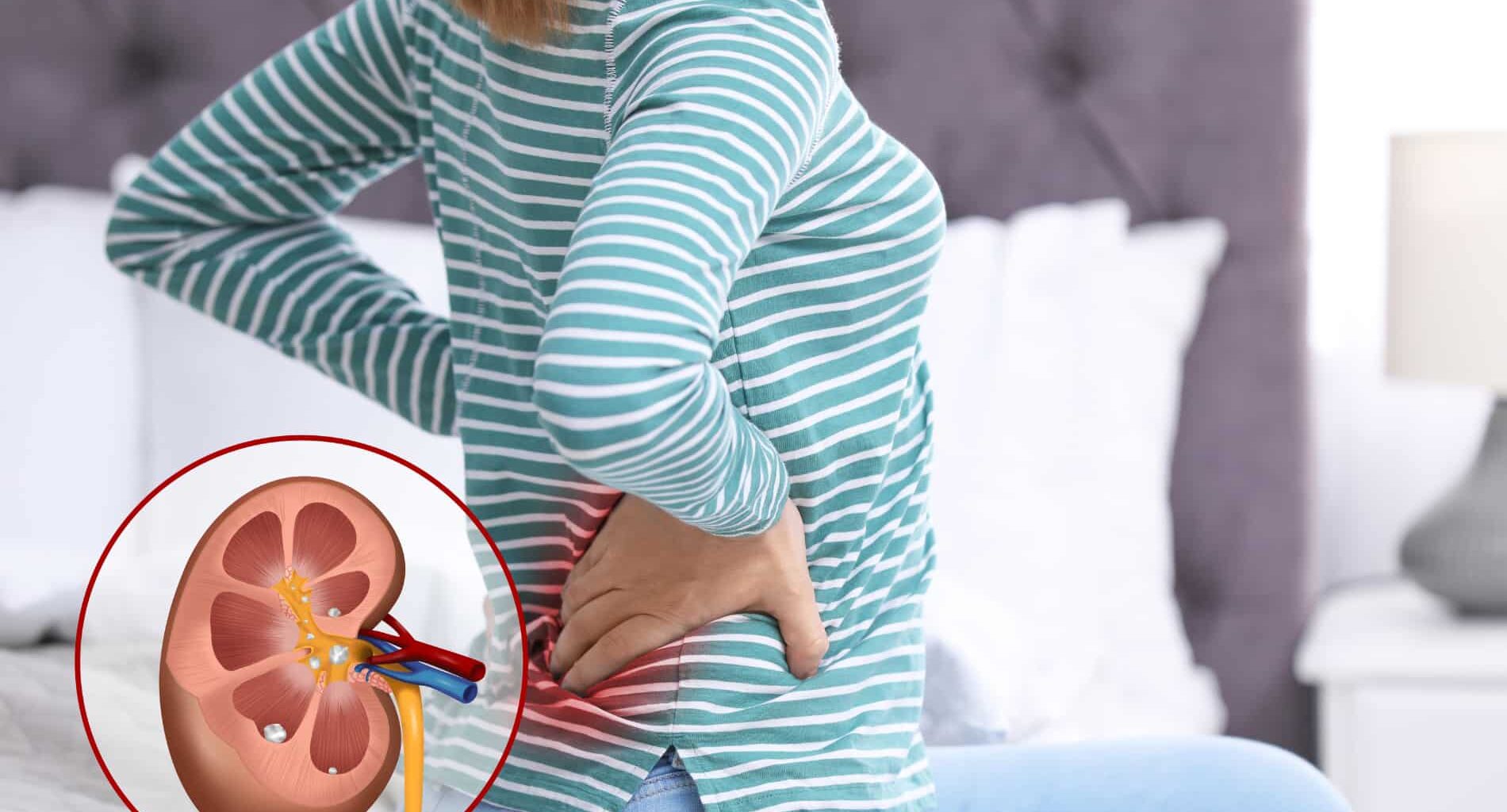 Pessoa com dor lombar – desconforto renal